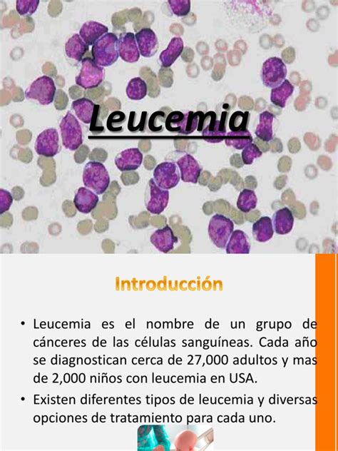 A Leucemia Linfoma Black Tie Black Jack