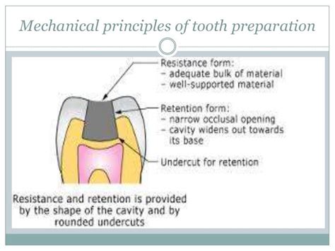 Dental Slots