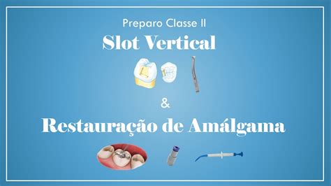 Slot De Preparacao De Classe 2